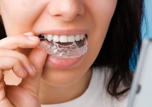 גשר שקוף אינויזליין