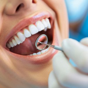 יישור שיניים למבוגרים