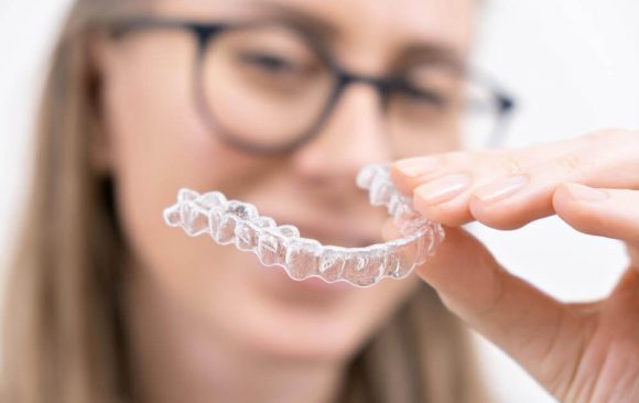 יישור שיניים למבוגרים המלצות