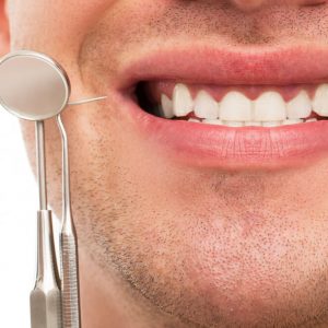 יישור שיניים לפני ואחרי