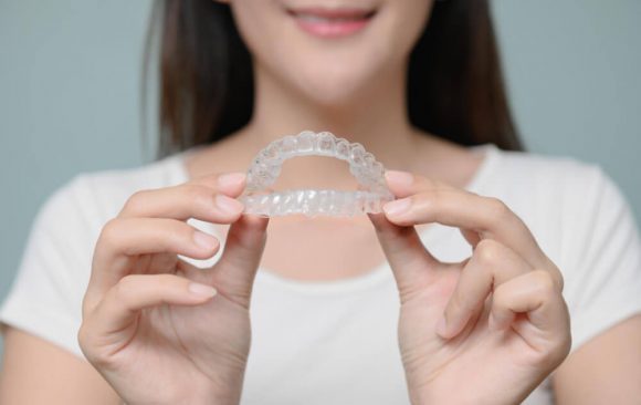 יישור שיניים שקוף מחיר